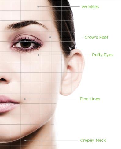 Chemical Peel Applications