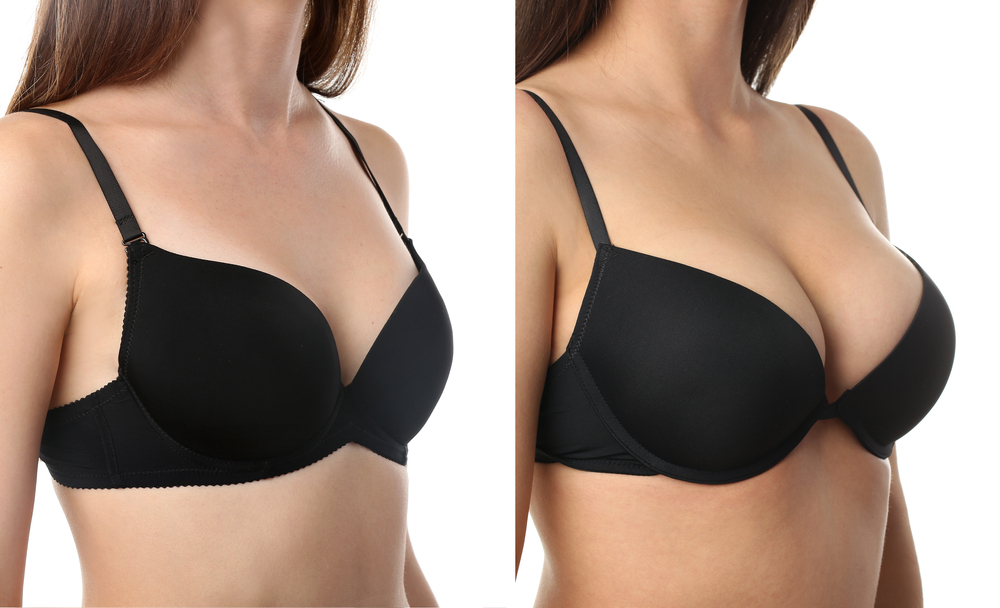 Breast Augmentation: How Long Does it Take? | Chicago Aesthetic Surgery Institute