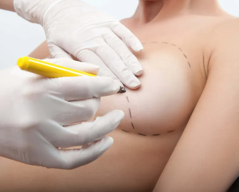 Breast Gallery
